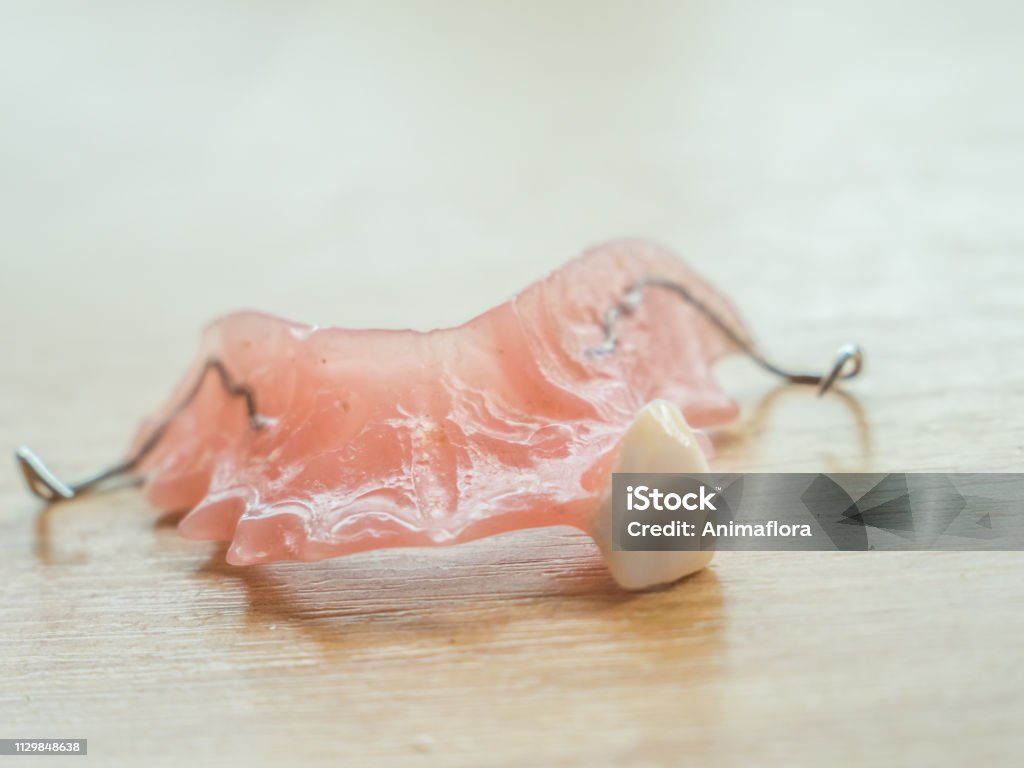 Tooth prosthesis with one tooth, bracket prosthesis