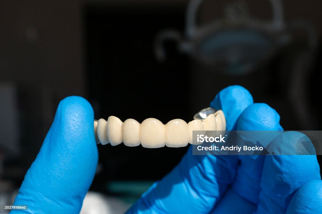 The doctor holds in his hands a zirconium prosthesis for all the teeth of the jaw.
