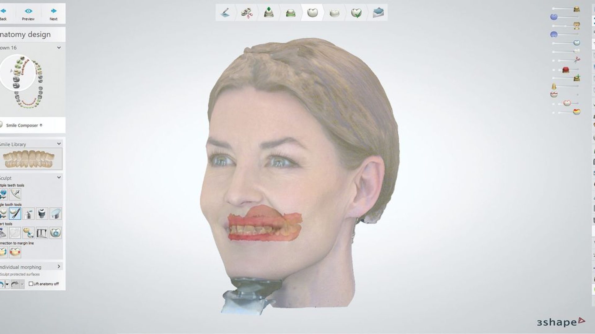 csm_Dental-System-Improved-Core-Workflow-Image-2018_small_cf03ad31b7