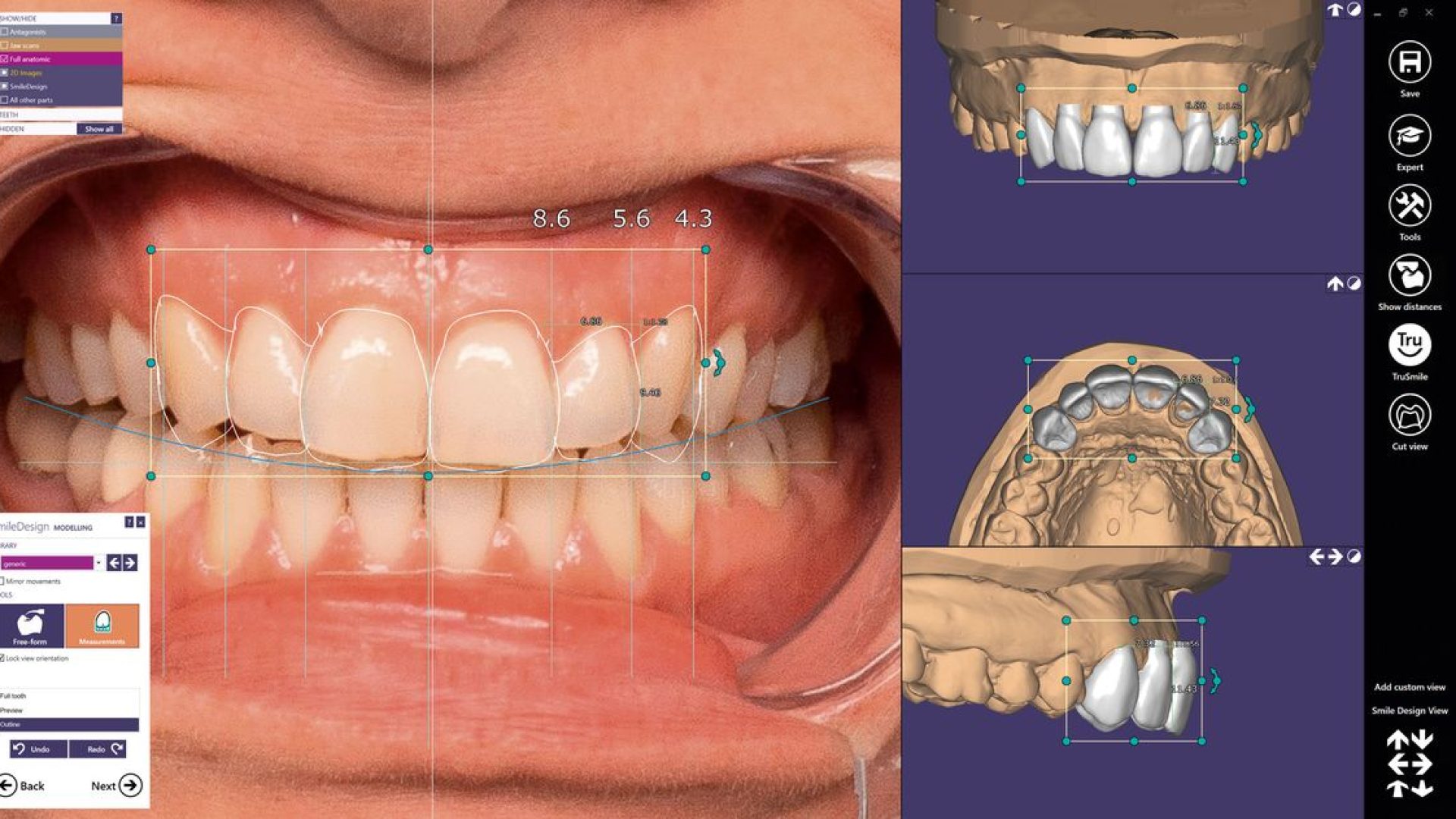csm_exocad_Smile_Creator_Page_05_Screenshot_SmileCreator_05b2d41512