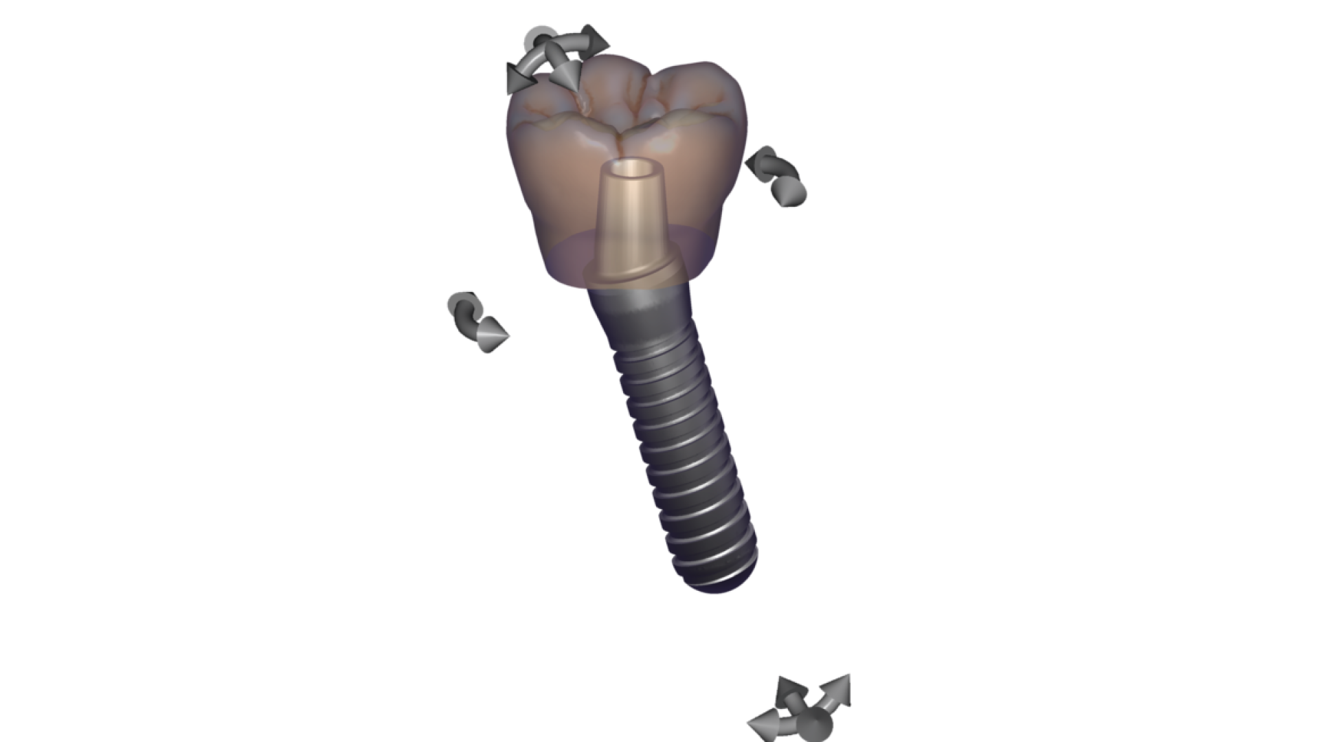 csm_exocad_exoplan_Page_06_Free_choice_2a79704928
